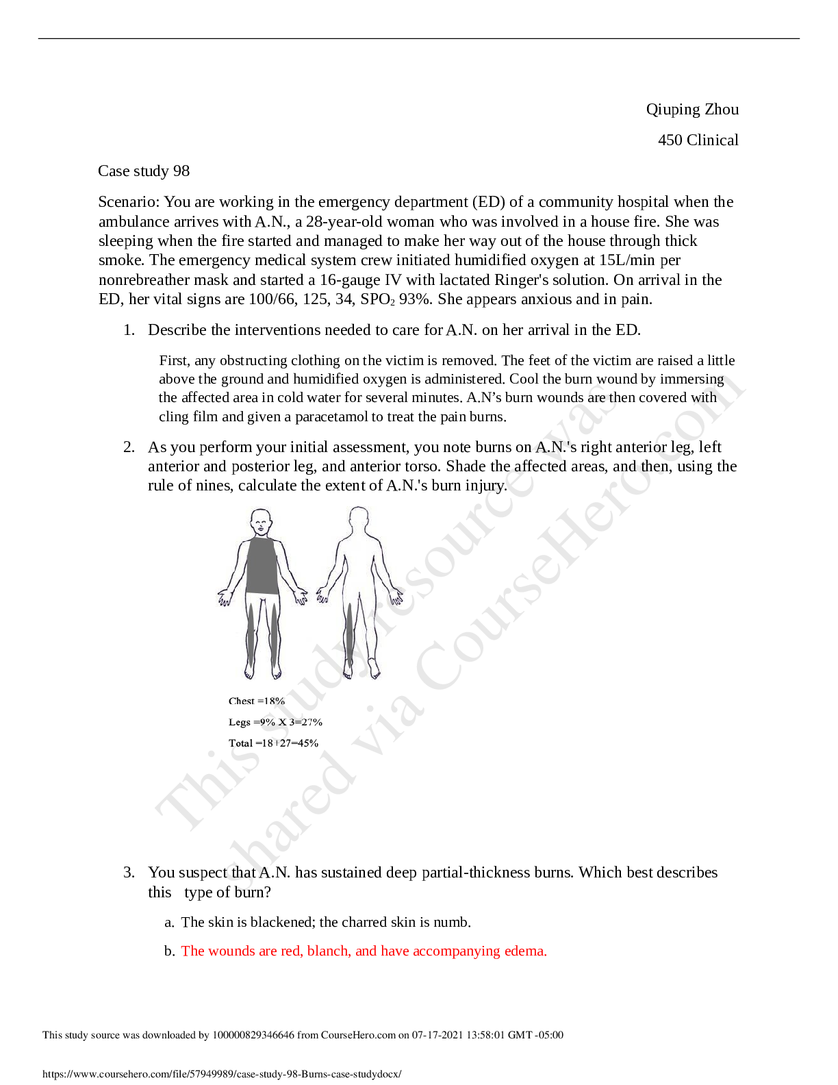Preview image for case study 98 Burns case study